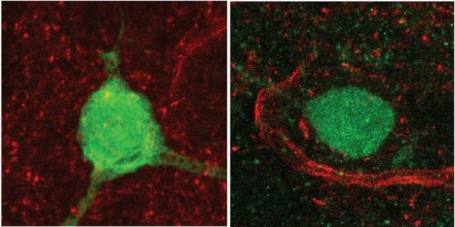 S'identifica per primera vegada la relació entre una mutació genètica de l'autisme i una hormona clau per a la conducta social