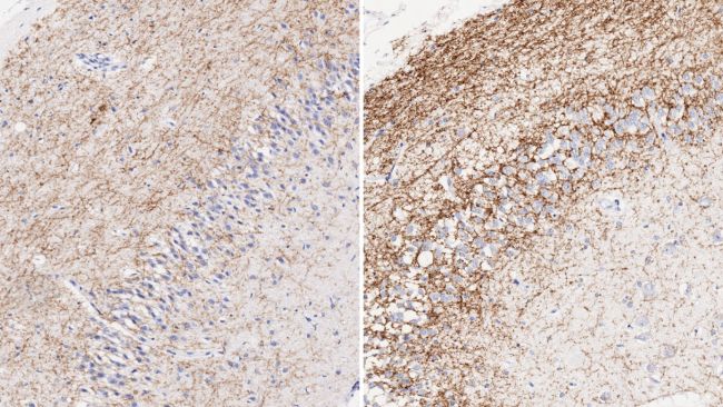 sistema endocannabinoide