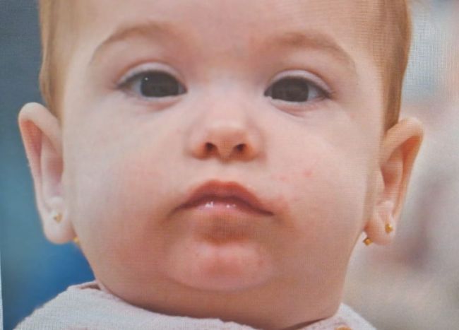 Famílies d'arreu de l'Estat exigeixen potenciar el diagnòstic genètic precoç per a una epilèpsia rara en nadons